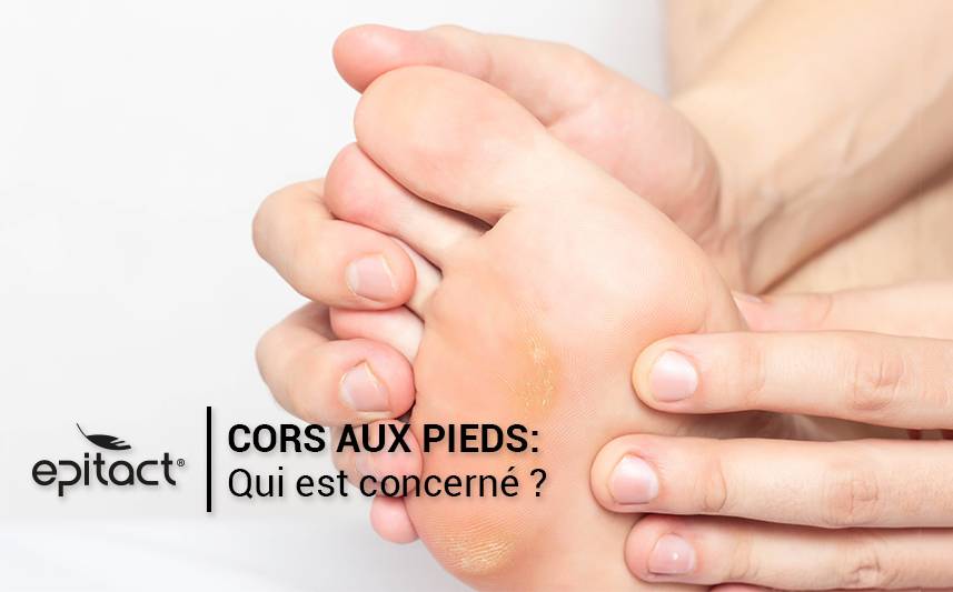Qui est concerné par les cors aux pieds ?