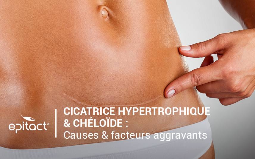Cicatrices chéloïdes & hypertrophiques : causes et facteurs aggravants