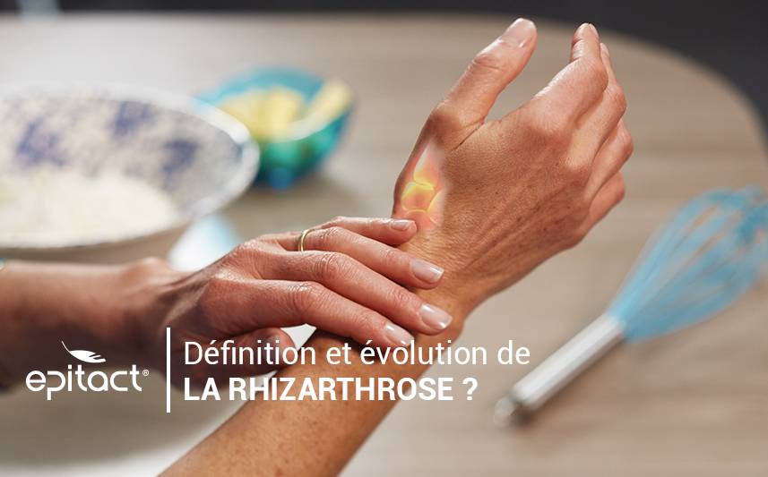 Définition et évolution de la rhizarthrose ou arthrose du pouce