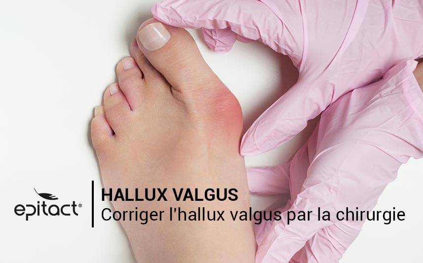 Corriger la déformation de l'hallux valgus par la chirurgie