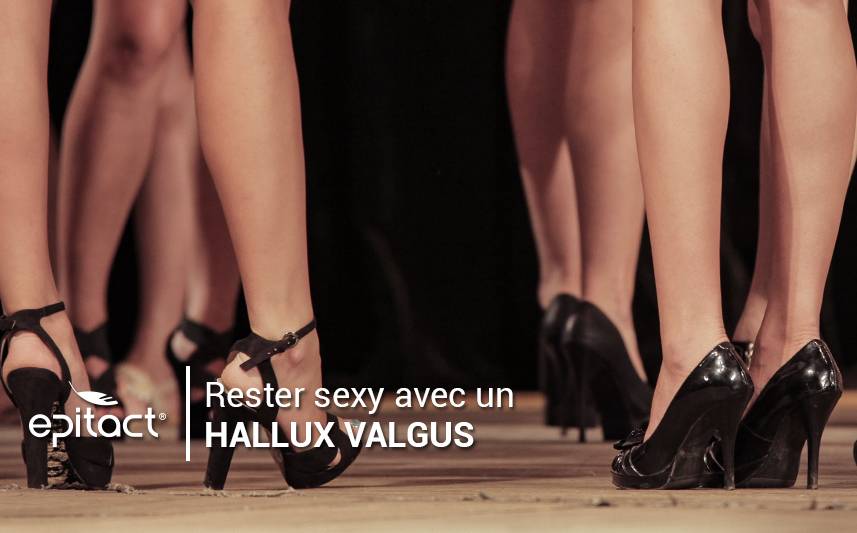 Comment rester sexy avec un hallux valgus ?