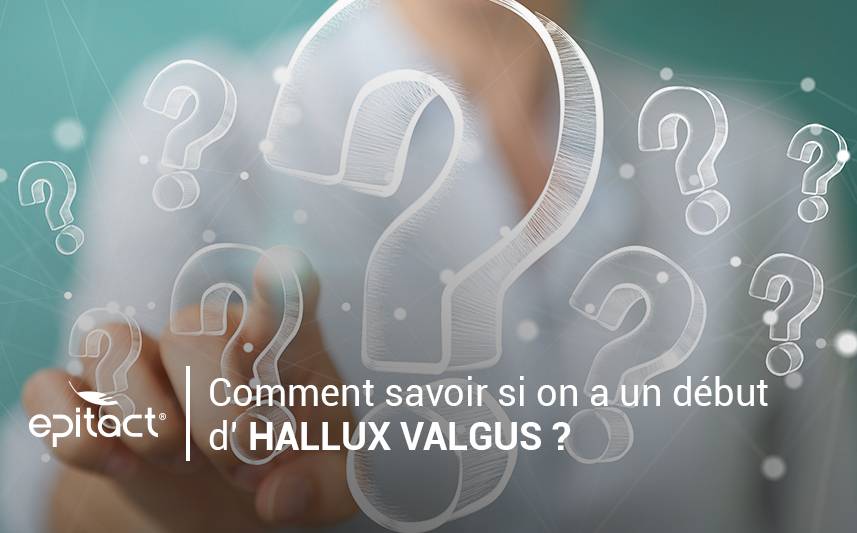 Comment savoir si on a un début d'hallux valgus ?