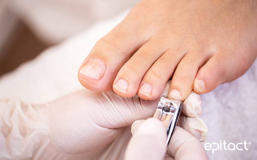 Que faire en cas de bleu sous l'ongle de pied ?