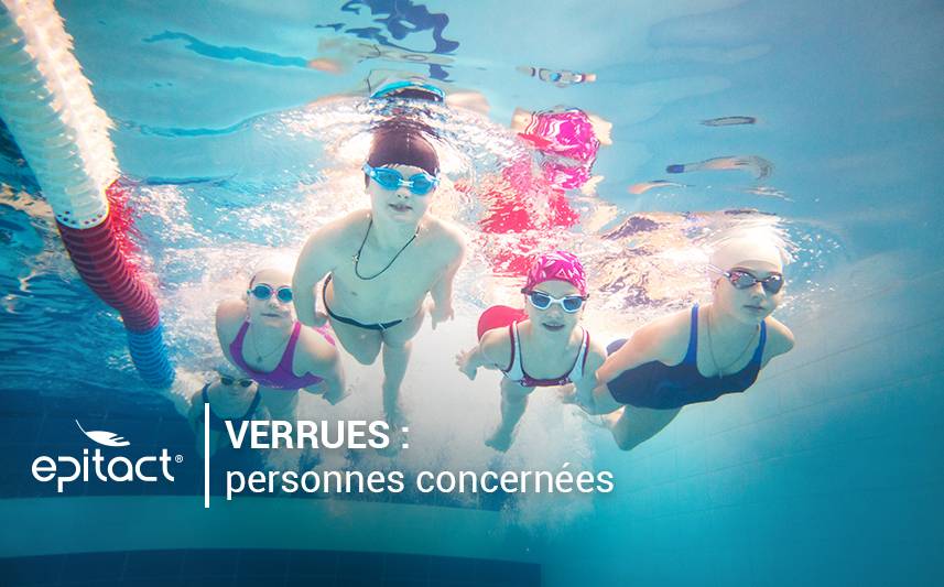 Verrues plantaires : étiologie, qui est concerné ?