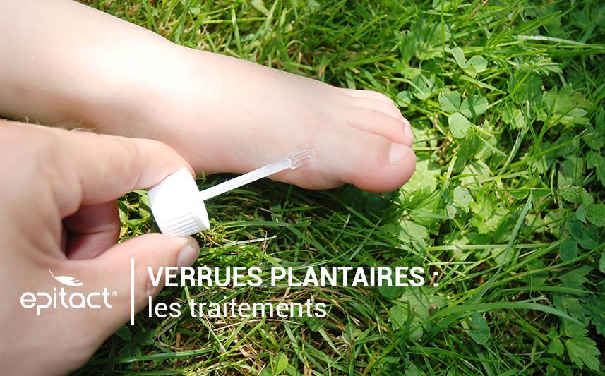Traitement contre les verrues plantaires : avez-vous tout essayé ?