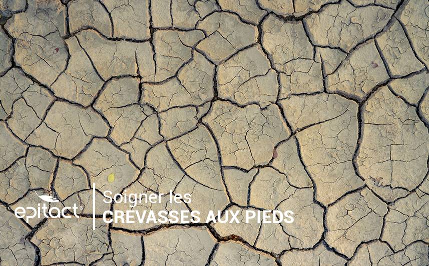 Quel soin contre les pieds secs & crevasses ? 