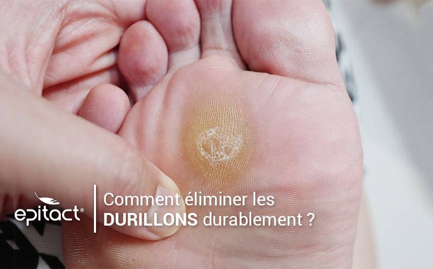 Enlever durablement un durillon sous le pied