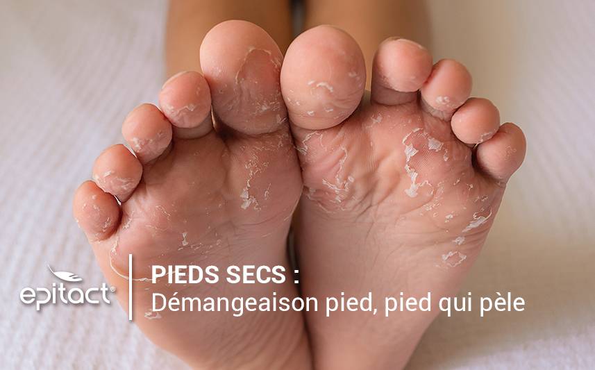 Pied qui démange ou qui pèle