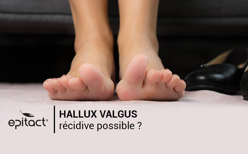Récidive d'hallux valgus : comment l'éviter ?