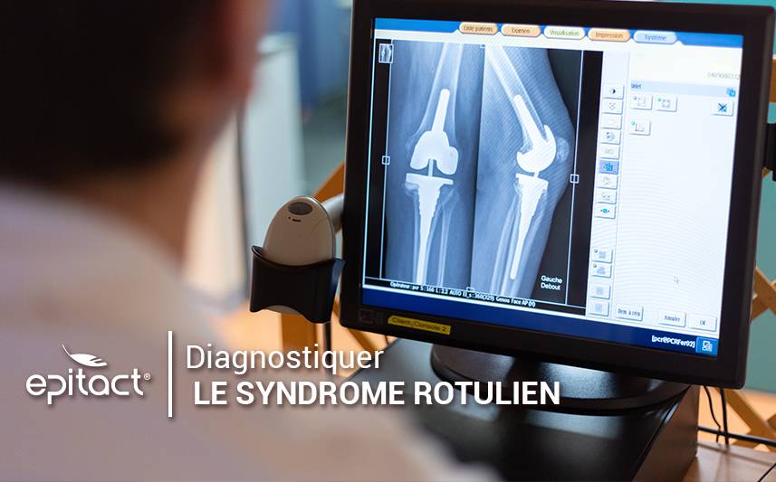 Diagnostiquer le syndrome rotulien