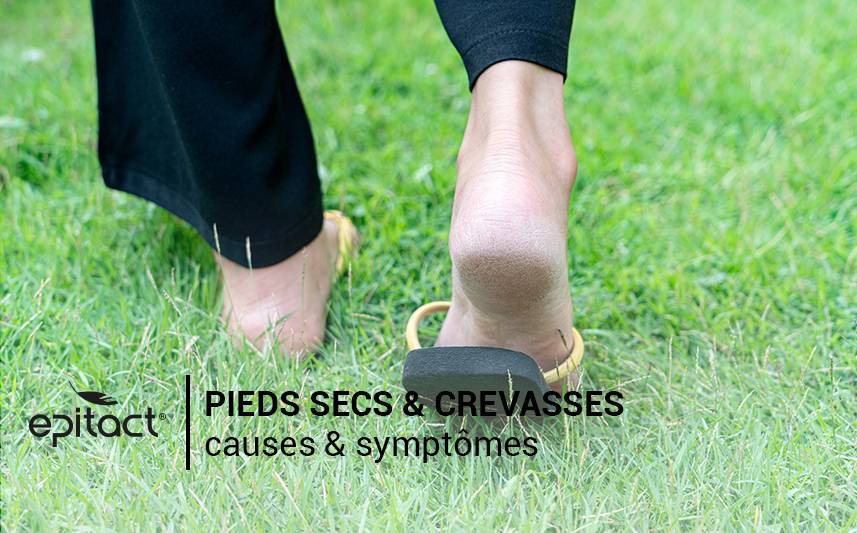 Pieds secs : découvrez les causes & symptômes