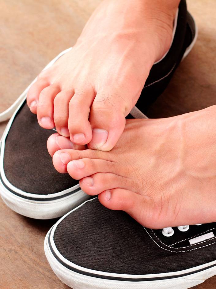 Cors aux pieds et orteils en griffe