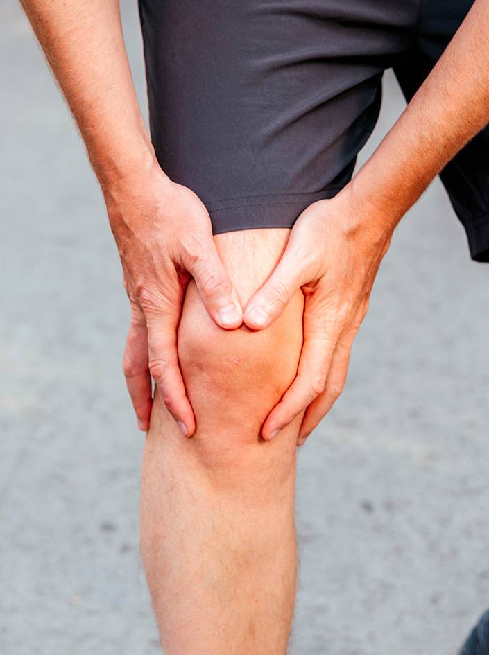 Tout savoir sur la gonarthrose (arthrose du genou)