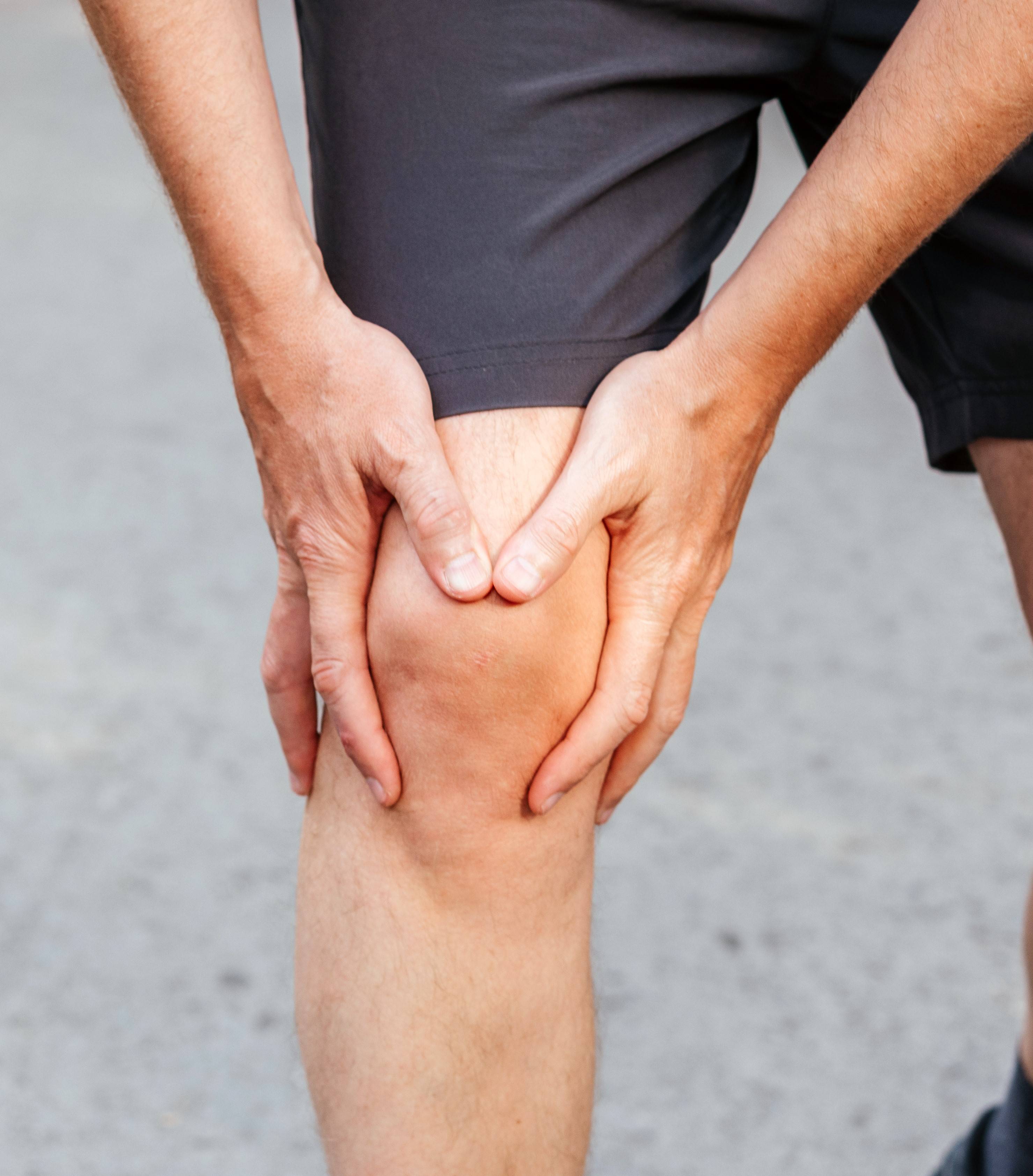 Tout savoir sur la gonarthrose (arthrose du genou)